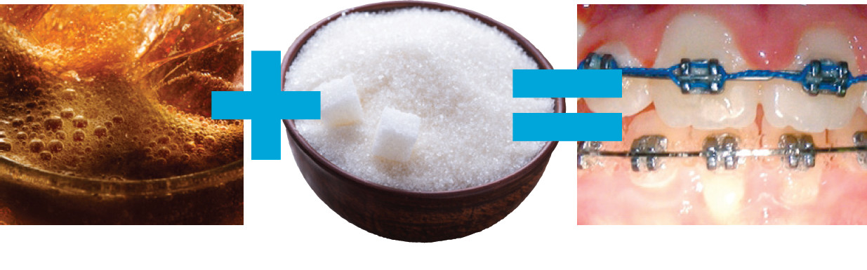 aparatos de azúcar de soda